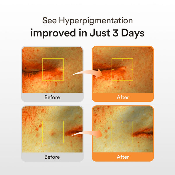 Glutathiosome dark spot serum Vita drop