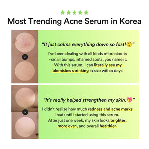 Heartleaf Teca capsule serum Calming drop 50ml