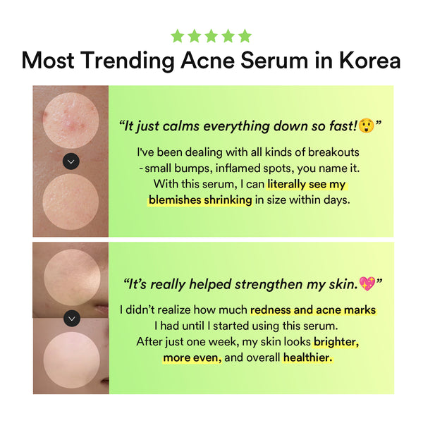 Heartleaf Teca capsule serum Calming drop 50ml