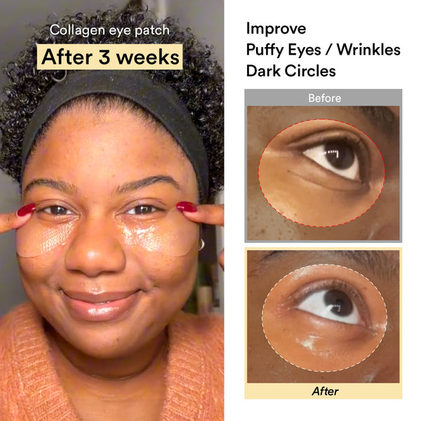 Collagen eye patch Jericho rose jelly