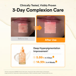 Glutathiosome dark spot serum Vita drop 50ml