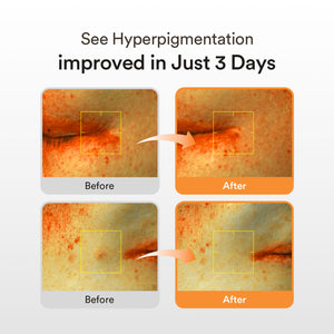 Glutathiosome Spotless glow Duo 70pcs+50ml